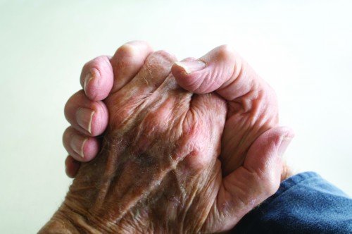 arthritic hands of an old  man